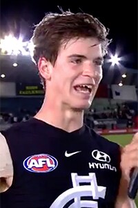 PaddyDowteeth300x300.jpg Paddy Dow shows off his nasty injury - AFL,JLT Series,Carlton Blues,St Kilda Saints,Alan Richardson,Brendon Bolton,Paddy Dow,Jarrod Garlett